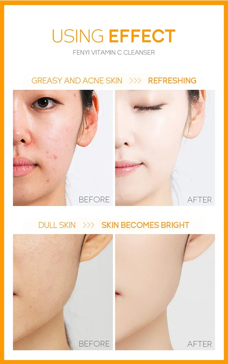 Vitamin C & Cherry Blossom Face Wash | Hydrating & Blackhead Care