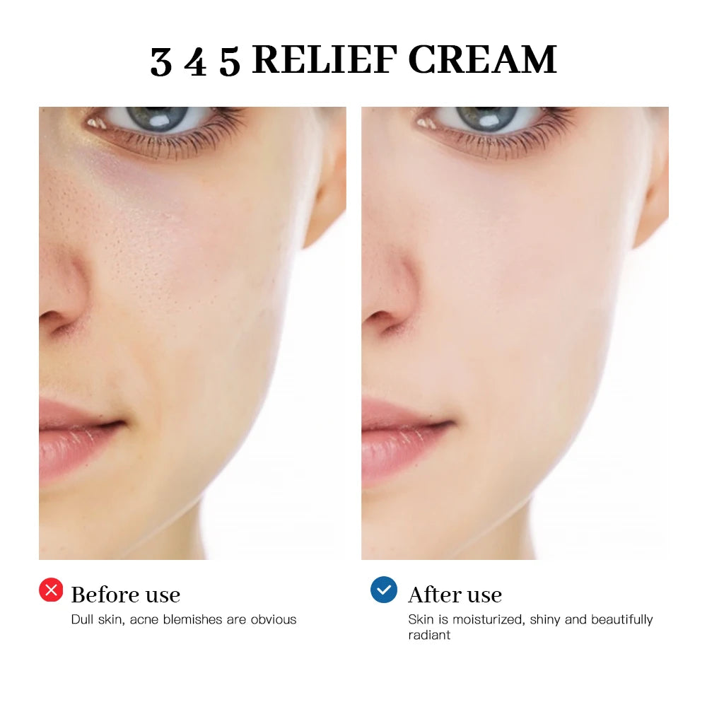 345 Relief Cream: Anti-Oxidant, Brightening & Acne Mark Care