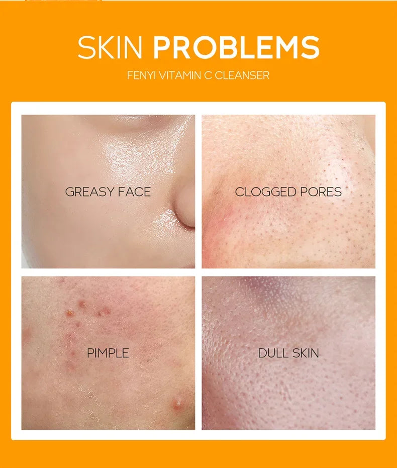 Vitamin C & Cherry Blossom Face Wash | Hydrating & Blackhead Care